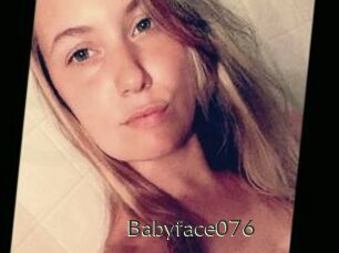 Babyface076